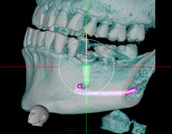 歯科専用CT：イメージ3