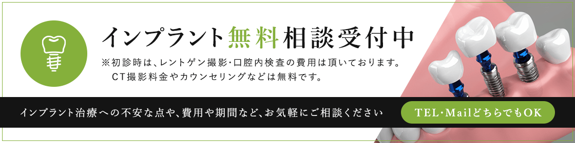 インプラント無料相談受付中 ※ 初診時は、レントゲン撮影・口腔内検査の費用は頂いております。CT撮影料金やカウンセリングなどは無料です。インプラント治療への不安な点や、費用や期間など、お気軽にご相談ください