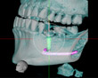歯科用CTの資料2